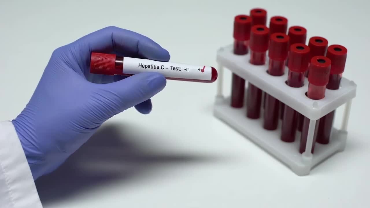 gdm0p15r9z0j139yl87jkeo2