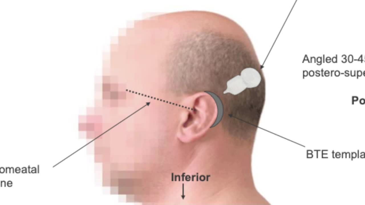 rgp5l1vaeba2gr2z87x4j93n