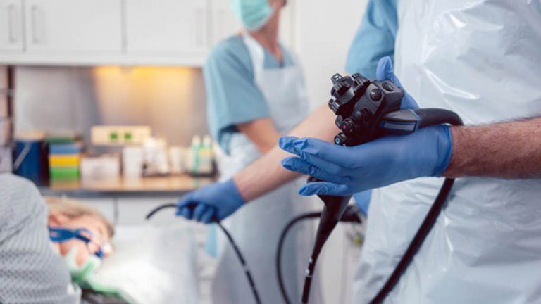 eNDOSCOPIA DIGESTIVA