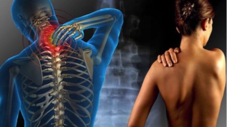 Fibromialgia-dolori-muscolari-1280x720