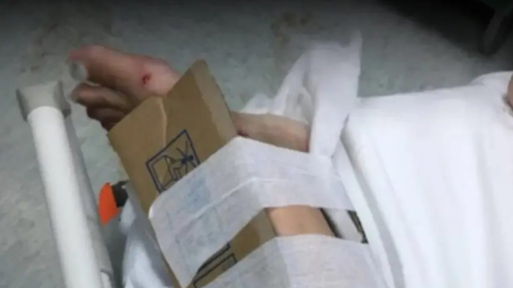 GAMBA FRATTURATA CARTONE PATTI 2024