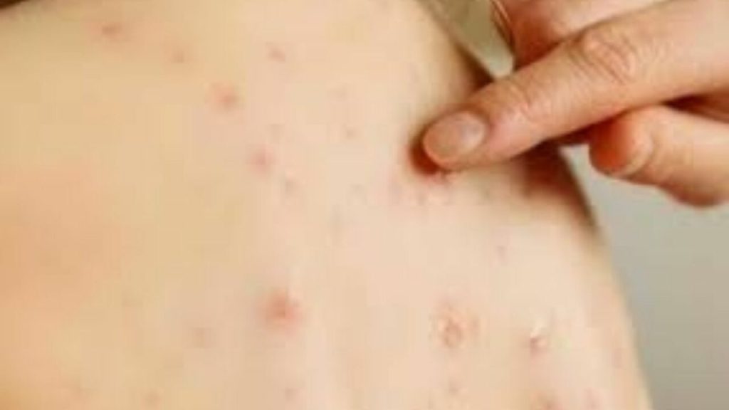 vaiolo-delle-scimmie-1-1280x720