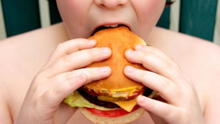 obesità infantile