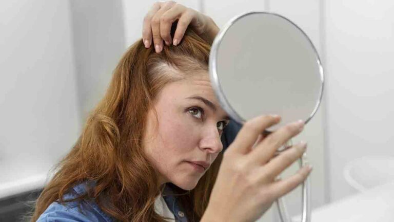 Summer-Hair-Loss-scaled